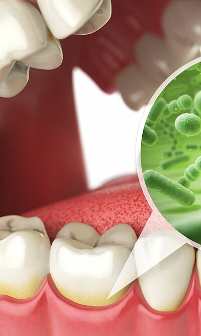 3 edibles that are beneficial for oral health