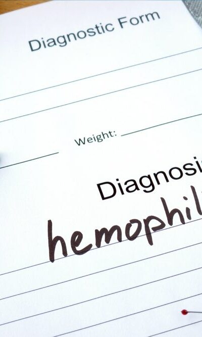 Here&#8217;s what to eat for hemophilia