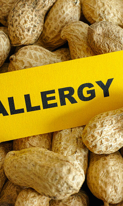 5 most common food allergies