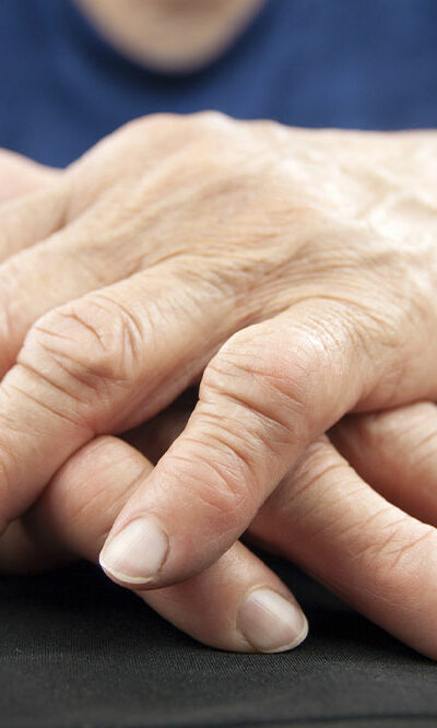 7 tips for living better with rheumatoid arthritis