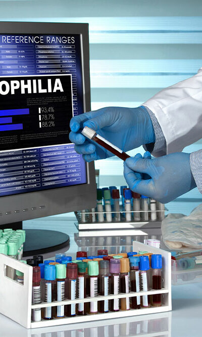 5 ways to live healthy with hemophilia