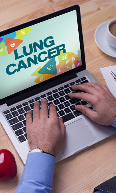 3 tips to manage lung cancer