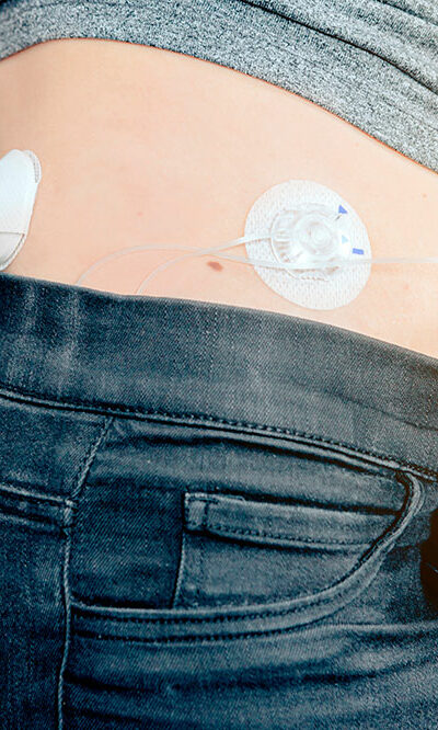 Insulin pumps &#8211; 3 best devices to buy in 2021