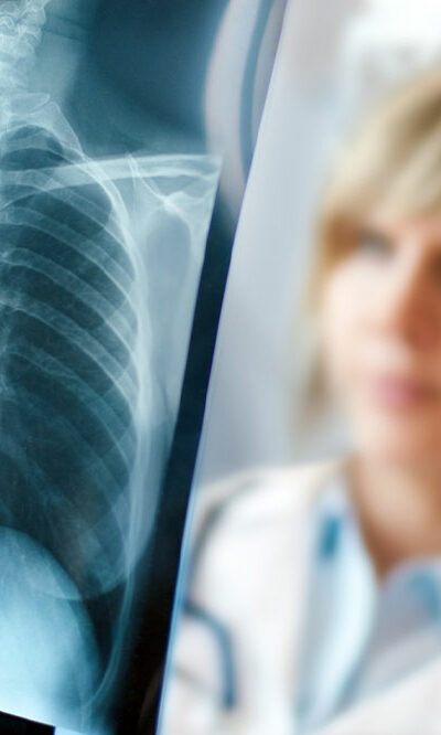 5 mistakes that can affect lung health