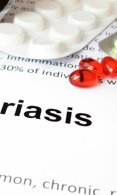 6 common health conditions related to psoriasis