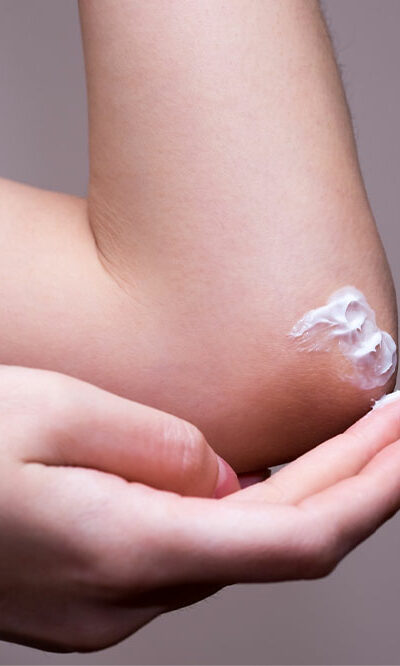 Top 7 topical lotions for managing eczema flareups