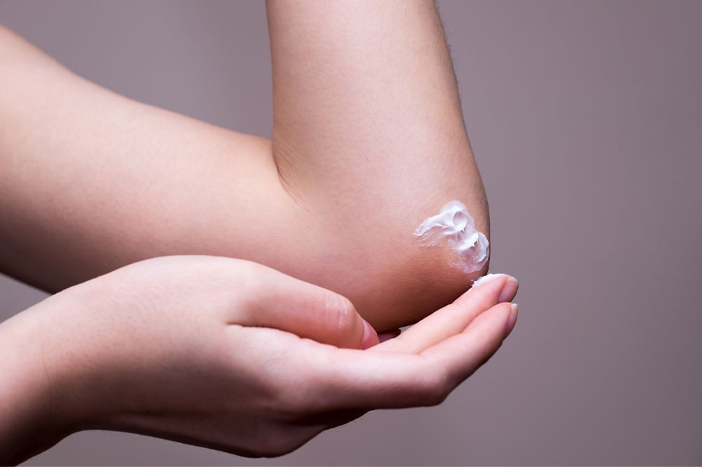 Top 7 topical lotions for managing eczema flareups