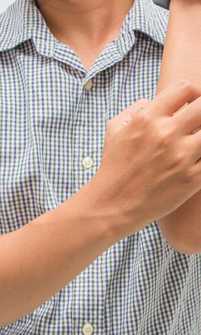 10 warning signs of eczema to watch out for