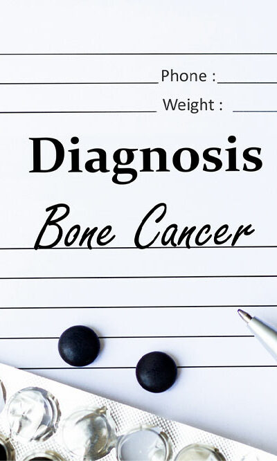 9 warning signs that indicate bone cancer